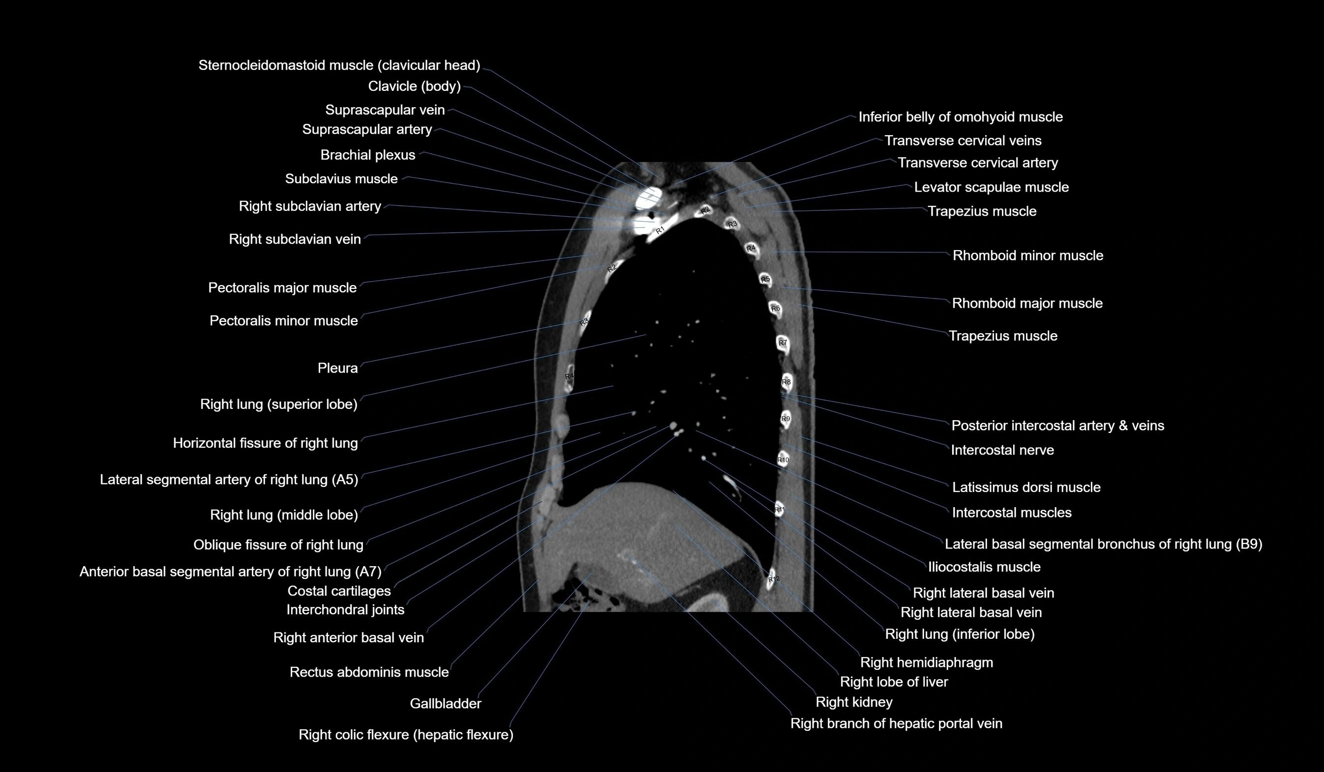 CT chest (thorax) labelled sagittal cross sectional anatomy radiology image-00045.webp
